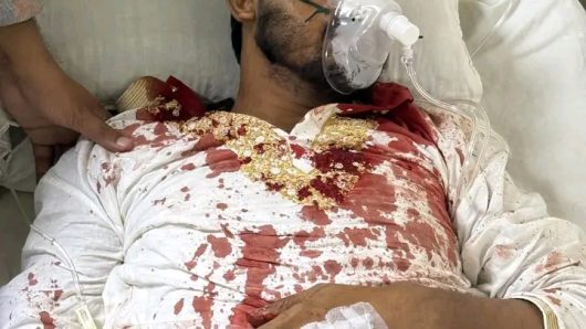 কাকরাইলে জাতীয় পার্টির কার্যালয়ে সামনে দুই গ্রুপের সংঘর্ষ, আহত নুরুল হক নূর সহ অনেক