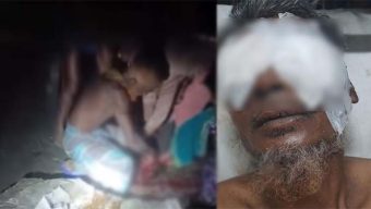 বরিশালে ভাইয়ের চোখ উঠিয়ে নেয়ার ঘটনায় অভিযুক্ত এক ভাই গ্রেপ্তার