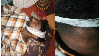 চরকাউয়ায় জমি সংক্রান্ত বিরোধে হত্যাচেষ্টা, আহত রাজু মুন্সী