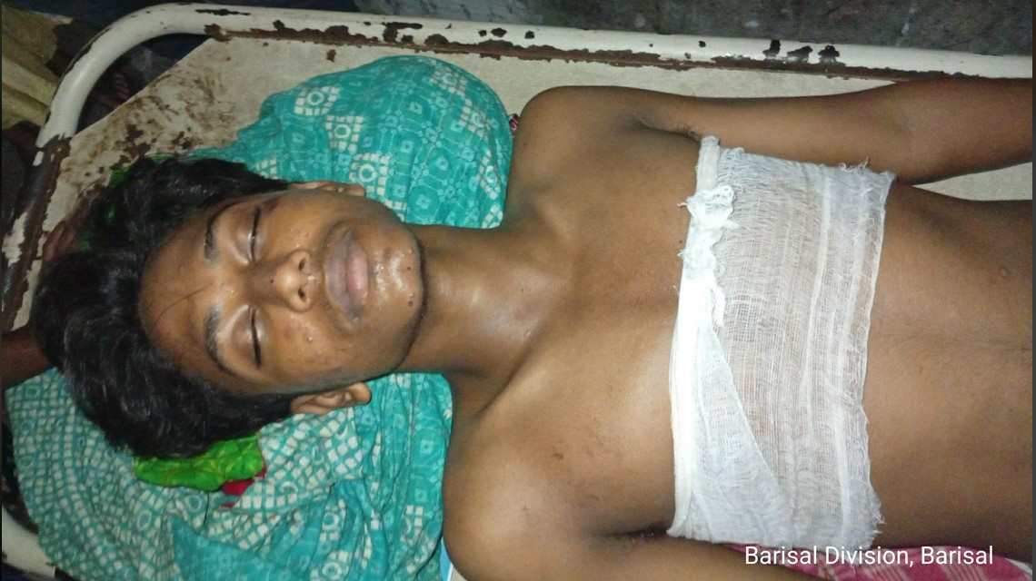 আমতলীতে ছাত্রদলের সদস্য সচিব ইমরানের নেতৃত্বে দুই কিশোরকে কুপিয়ে জখম