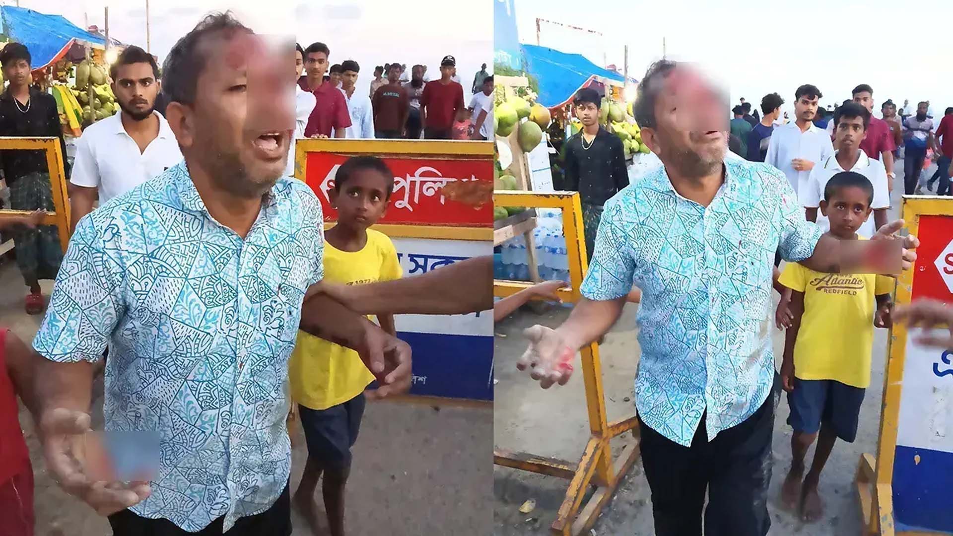 পটুয়াখালীতে মাছের ঘের নিয়ে বিরোধ, আইনজীবীকে পিটিয়ে জখম