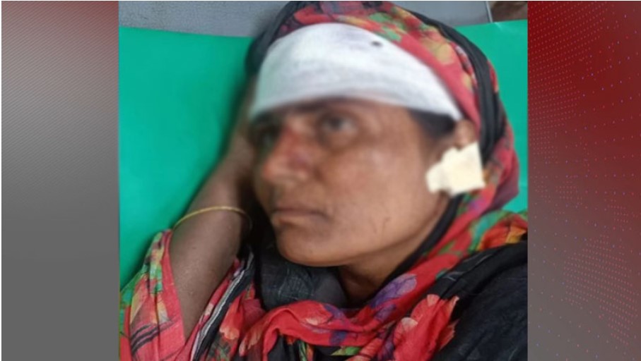 দাঁড়িপাল্লার প্রচারে বাধা, নারীর কান ছিঁড়ে মাথা ফাটালেন যুবদল নেতা