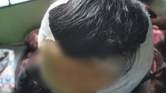 গণসংযোগকালে জামায়াতের নারী কর্মীর মাথায় কোপ