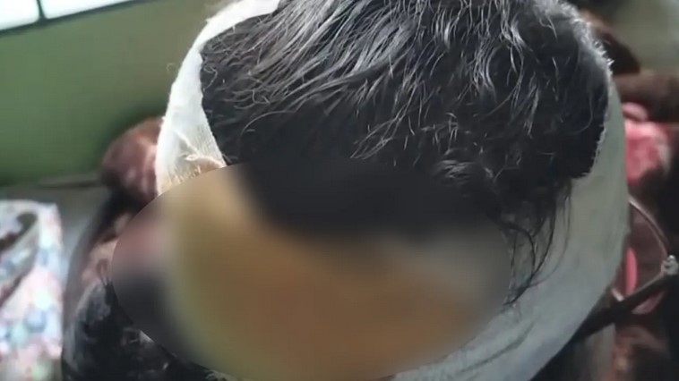 গণসংযোগকালে জামায়াতের নারী কর্মীর মাথায় কোপ