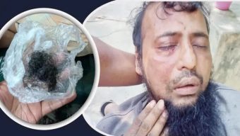 জামায়াত কর্মীকে পিটিয়ে দাড়ি ছিড়ে ফেললেন বিএনপি কর্মীরা