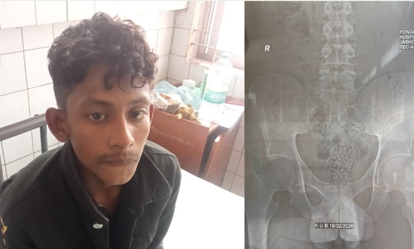যুবকের পেট থেকে ২২ শ ইয়াবা উদ্ধার