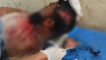 মহিপুরে মাদক সেবনে বাধা: যুবককে প্রকাশ্যে কুপিয়ে হত্যাচেষ্টা