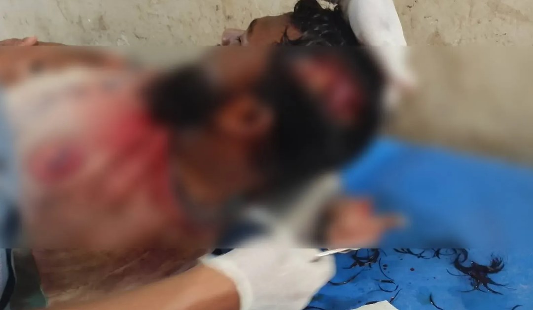 মহিপুরে মাদক সেবনে বাধা: যুবককে প্রকাশ্যে কুপিয়ে হত্যাচেষ্টা