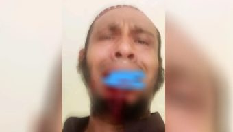 ঝালকাঠিতে অধ্যক্ষের ঘুসিতে দাঁত ভাঙল কম্পিউটার অপারেটরের