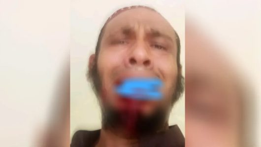 ঝালকাঠিতে অধ্যক্ষের ঘুসিতে দাঁত ভাঙল কম্পিউটার অপারেটরের