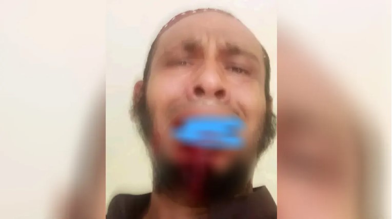 ঝালকাঠিতে অধ্যক্ষের ঘুসিতে দাঁত ভাঙল কম্পিউটার অপারেটরের