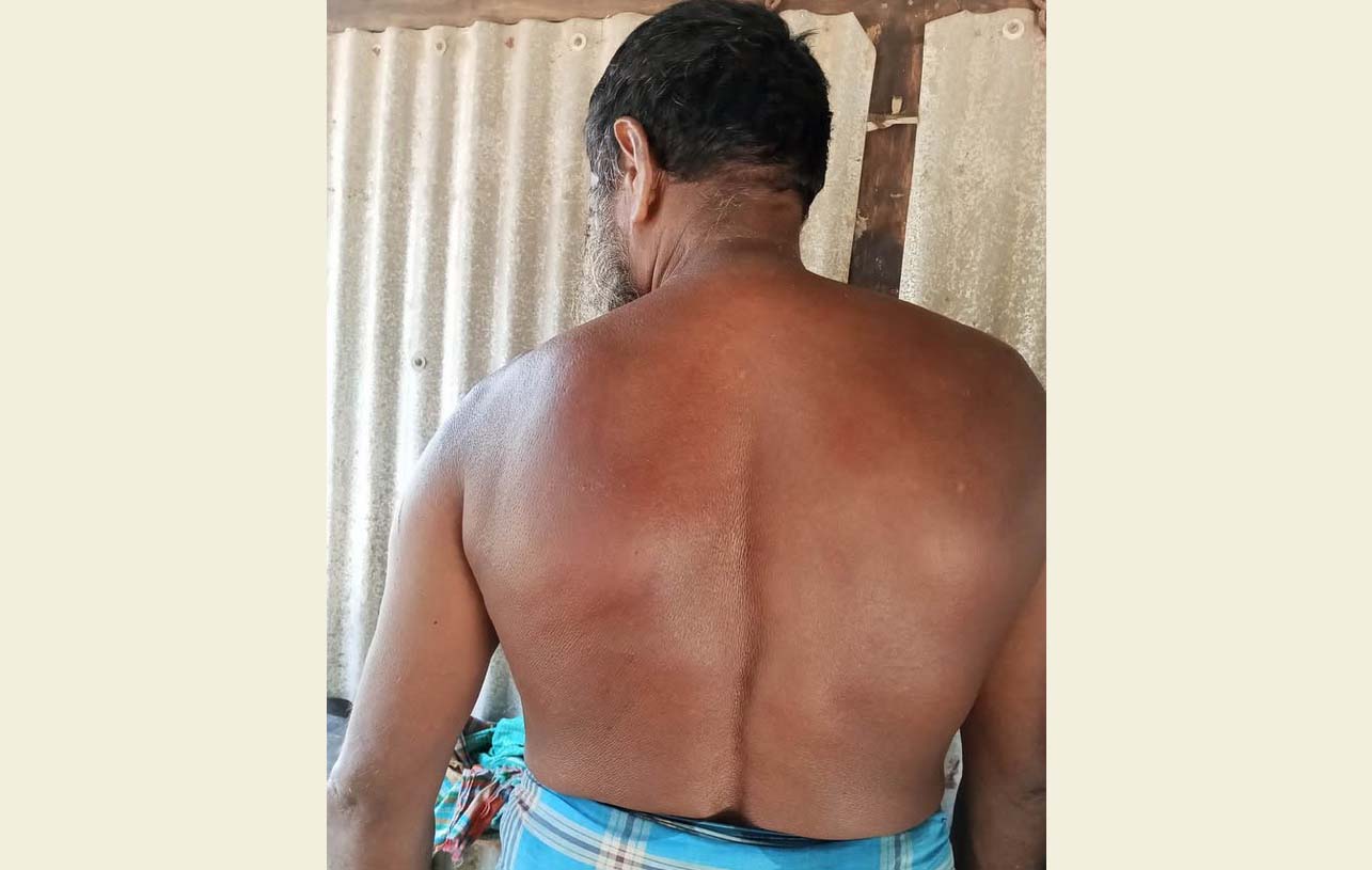 সাতলায় চুরির অপবাদ দিয়ে ঘের পাহারাদার বৃদ্ধ’র উপর অমানবিক নির্যাতন,থানায় অভিযোগ